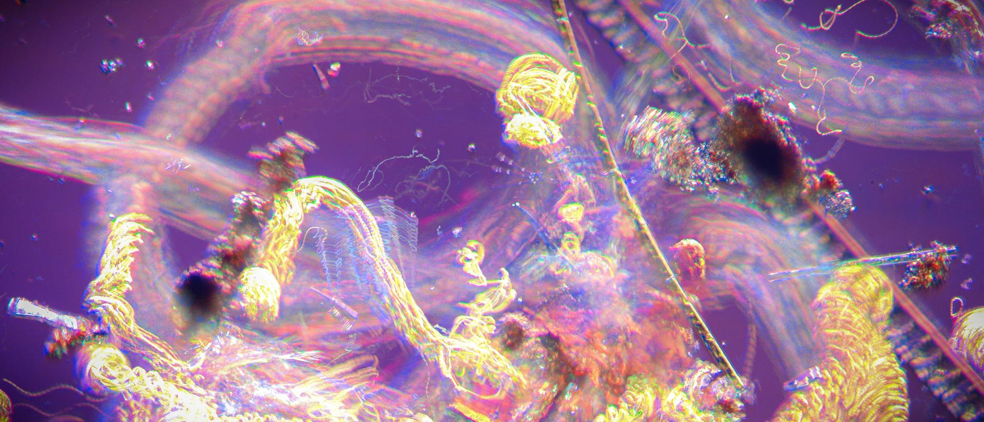 purple colors with yellow swirls, plankton under a microscope